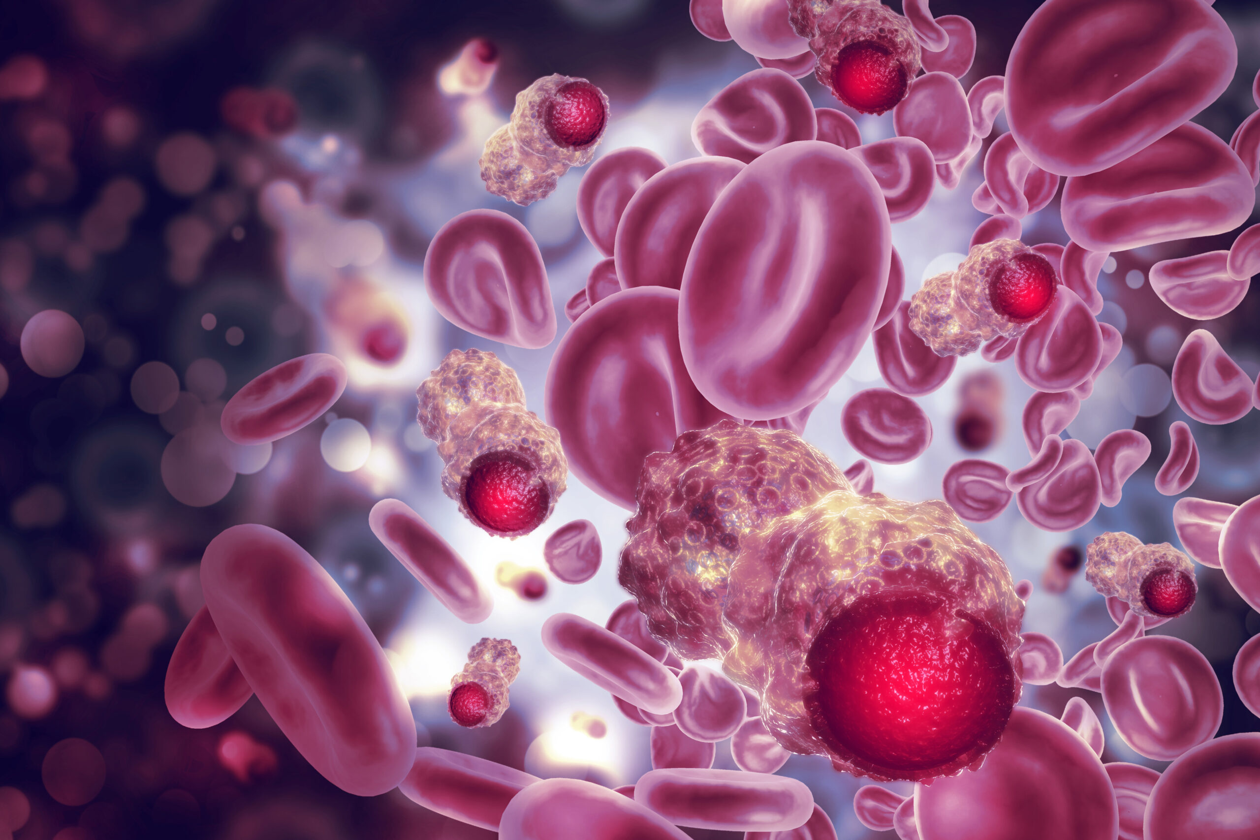 Targeted Therapy Combinations Shine in Upfront CLL Treatment