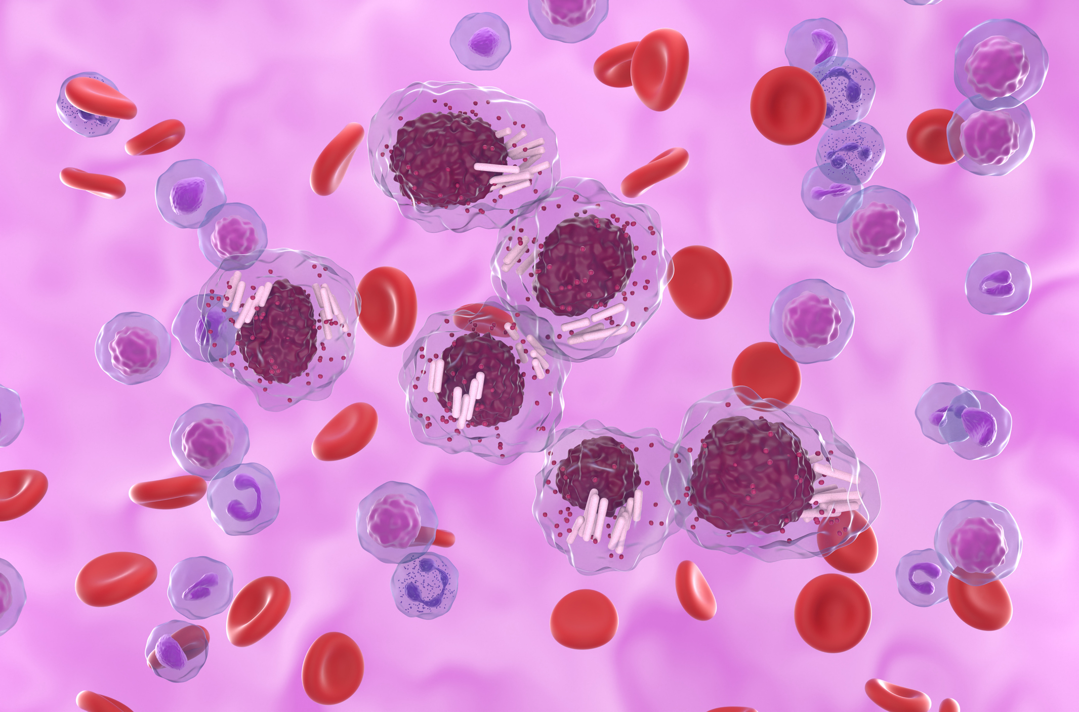Treatment Advances in Double-Refractory CLL Signal a Shift in Outlook