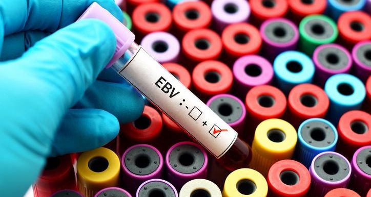 Pharmaceutical Company Issues Development Updates for Tabelecleucel in EBV+ PTLD