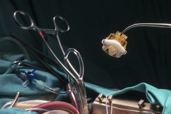 Mitral Valve-in-Valve: Who Lives Longer and Why?