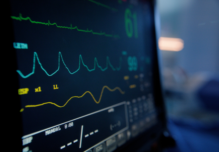 Insertable Cardiac Monitors Uncover Subclinical Atrial Fibrillation in a Third of Patients With Cryptogenic Stroke