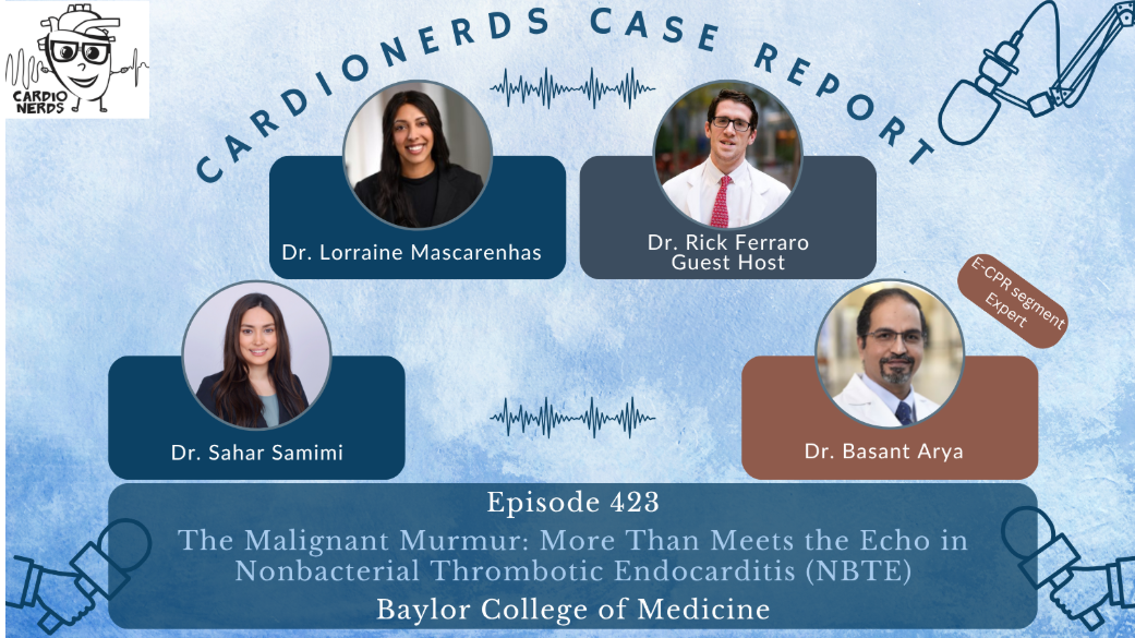 The Malignant Murmur: A Case of Nonbacterial Endocarditis