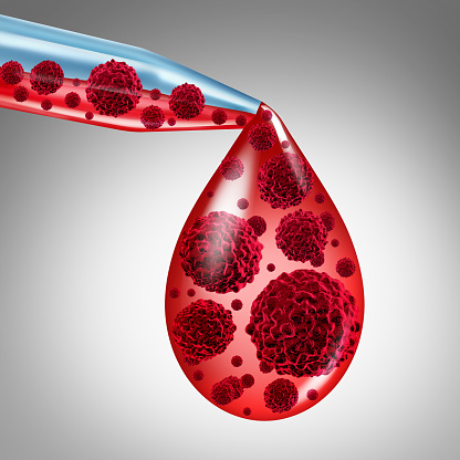 Study Shows the Natural History and Prognostic Factors at First ...