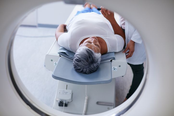 Study Recommends Refining Brain MRI Screening Guidelines for Asymptomatic Stage IV Breast Cancer