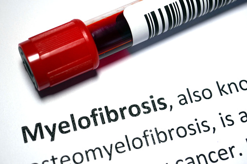 Examining Ruxolitinib Adherence Patterns in Patients With Myelofibrosis