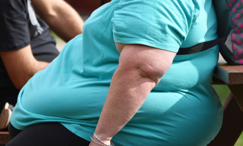 Obese Premenopausal Women More Likely to Be Diagnosed With Triple Negative Breast Cancer
