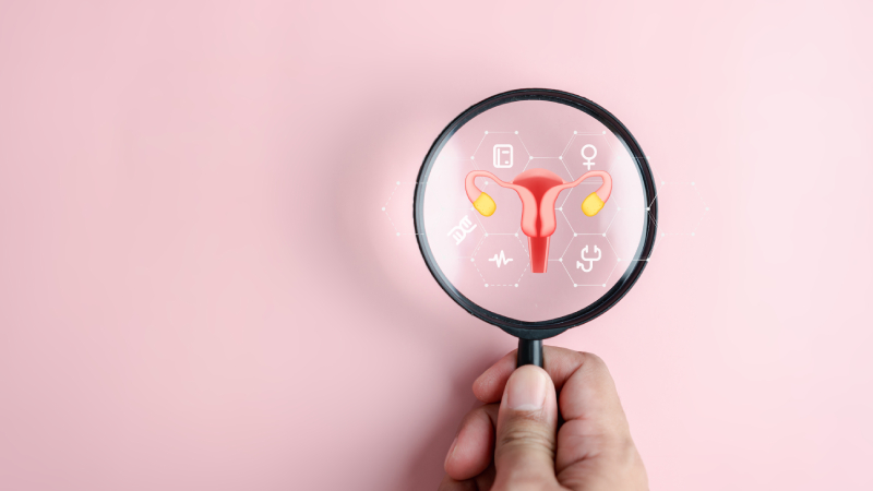 Symptom-Triggered Testing Helps Identify Ovarian Cancers Early