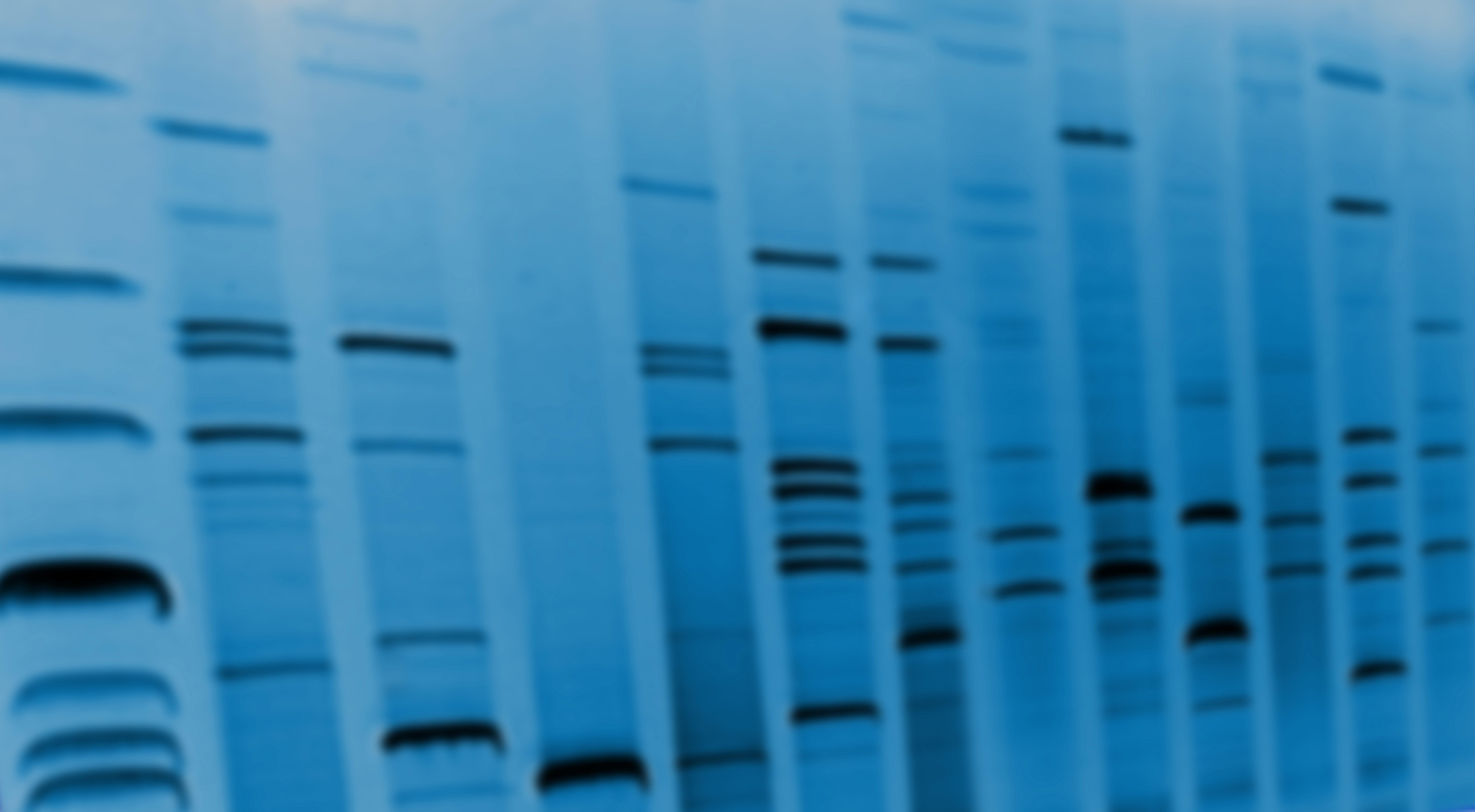 Analyzing Mutations in Over 17,000 Patients With Myeloid Malignancies