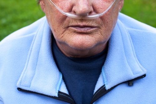 Targeted Lung Denervation for COPD at 12 Months