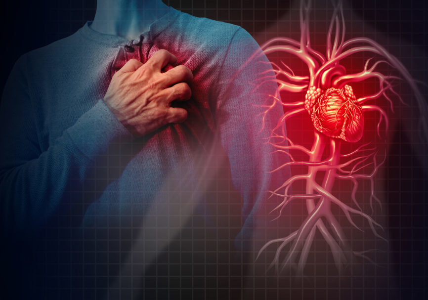 Can Stress Trigger a Second Heart Attack? Yes, New Research Suggests