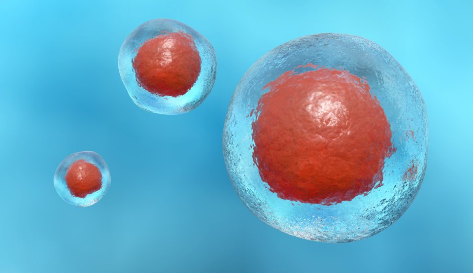 Study Shows CAR T-Cell Success in Solid Tumors