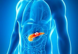 Is Exocrine Pancreatic Insufficiency a Predictor of Pancreatic Cancer Development?