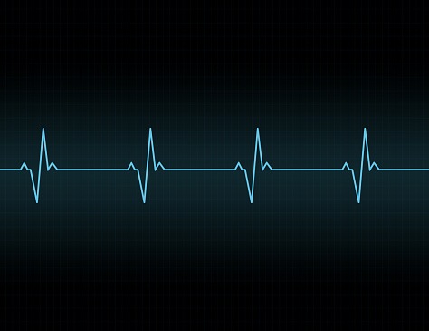 Artificial Intelligence Examining ECGs Predicts Irregular Heartbeat, Death Risk