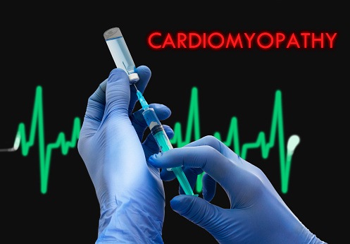 New Common Genetic Loci Related to Dilated Cardiomyopathy