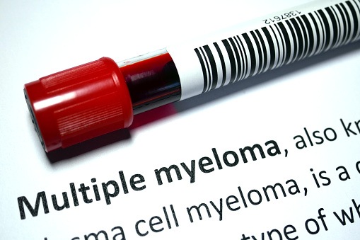 Study Finds Gap in Guideline-Directed VTE Prophylaxis in IMiD Therapy for Multiple Myeloma