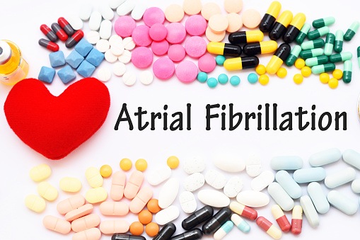 Monitoring of Potential Atrial Fibrillation Triggers May Reduce Episodes
