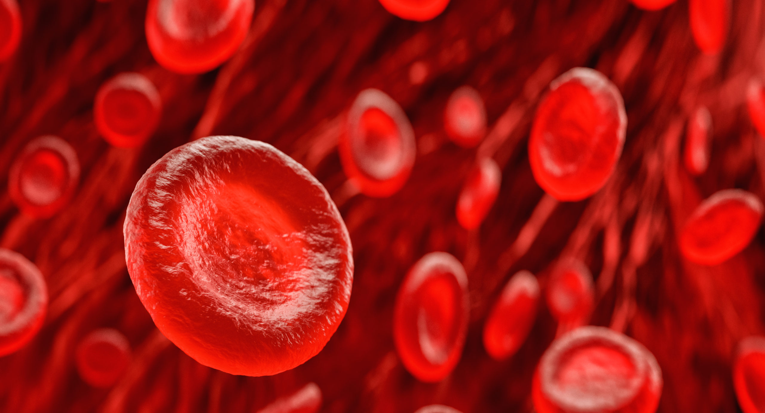 Red Blood Cell Transfusions in Patients With CKD and Anemia