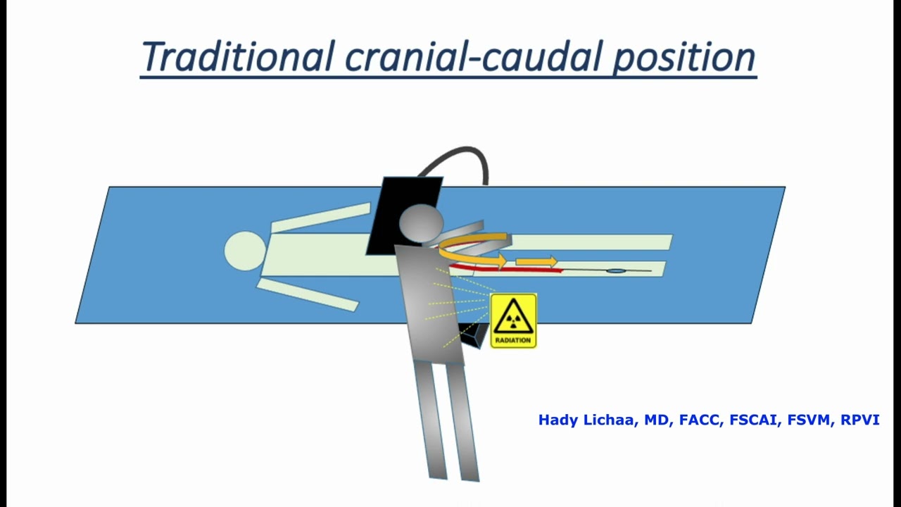 Practice Tips with Dr. Lichaa: Reversing Patient Cranial Caudal Position