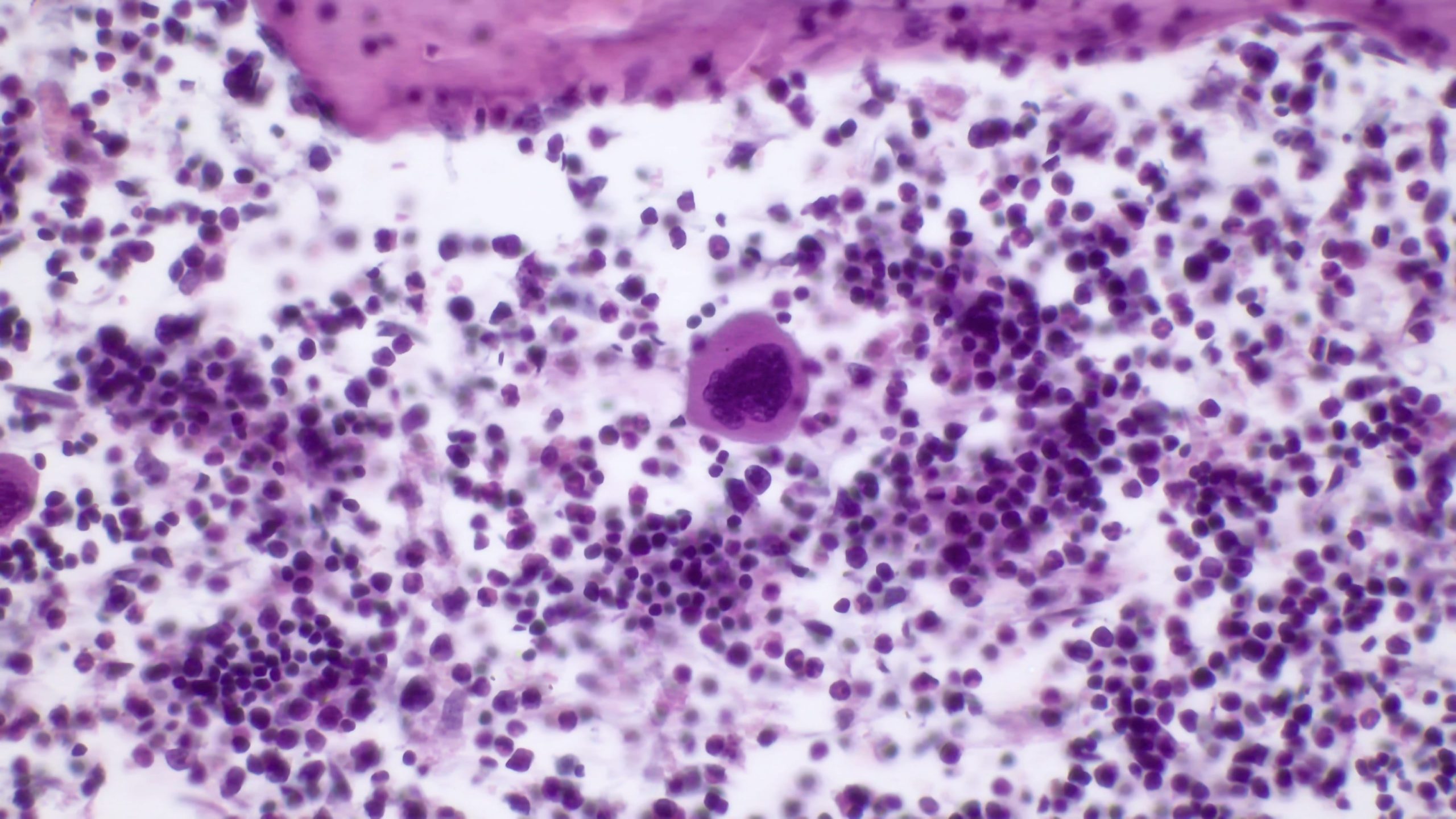 megakaryocyte in bone marrow