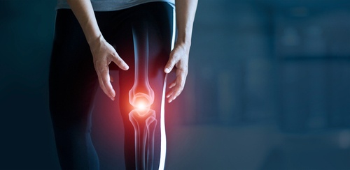 Total Body PET/CT Scans Effective for Evaluating Arthritis, Study Shows