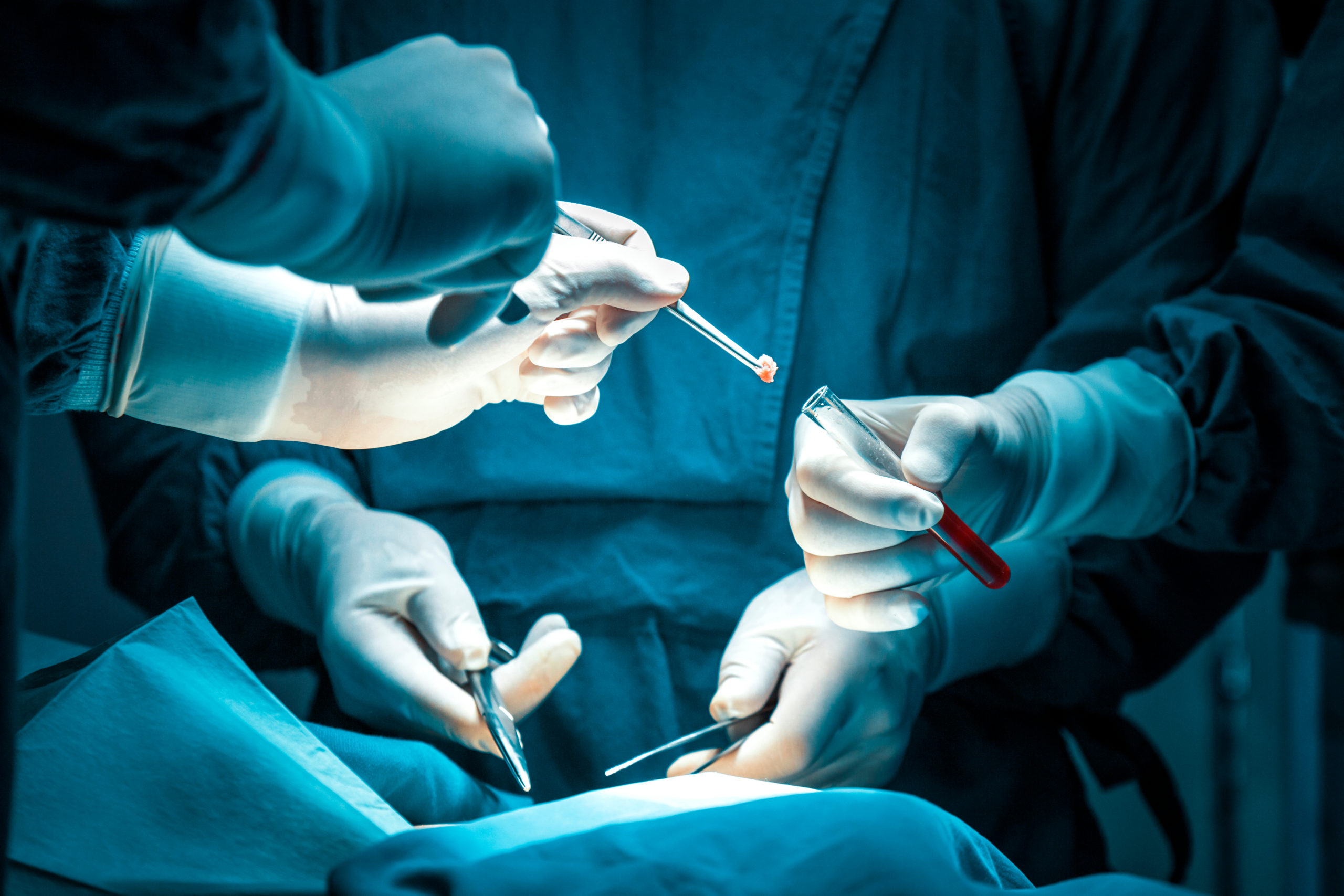 DDAVP Up the Nose to Prevent Biopsy Bleeding