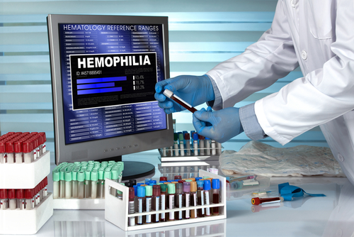 A Nuanced Method of Treating Acquired Hemophilia