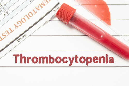 How to Properly Manage Thrombocytopenia