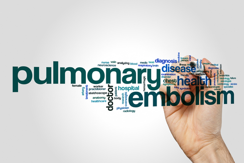 Mechanical Thrombectomy Improves Outcomes and Quality of Life in Pulmonary Embolism Patients
