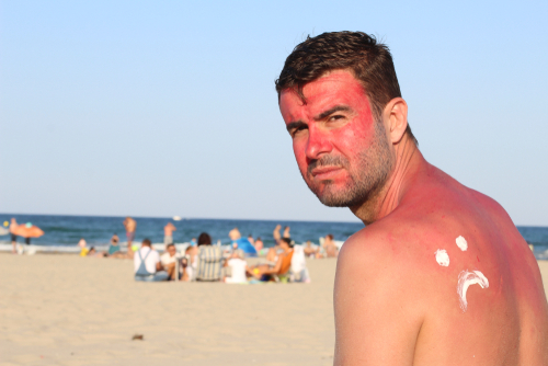 People With a History of Skin Cancer Lack Knowledge On Sun Protection