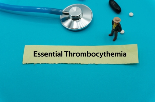 Pelabresib Monotherapy Is Beneficial in Patients With High-Risk Essential Thrombocythemia