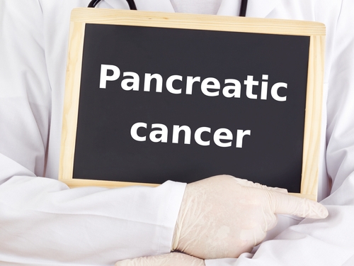 Clinically Distinguishing Between Pancreatic Cancer-Related and Type 2 Diabetes
