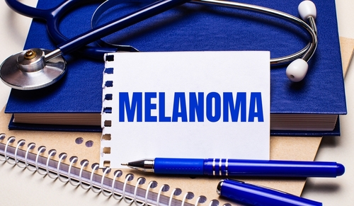 Adults With Type 2 Diabetes Taking DPP-4 Inhibitors Have a Lower Risk of Melanoma