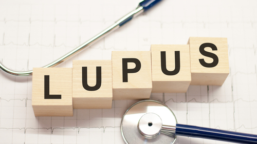 Voclosporin in Black Patients With Lupus Nephritis: AURORA Studies