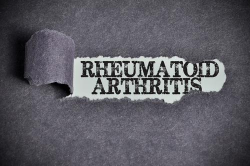 ACR Guidelines Recommend an Integrated Approach to Managing Rheumatoid Arthritis
