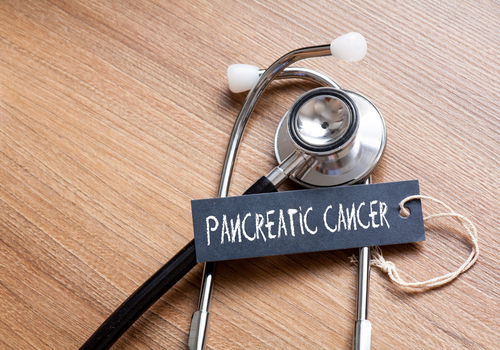 Potential Prognostic Value of ABC Factors for Localized Pancreatic Cancer