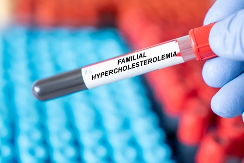 Leveraging Blood Bank Donation Programs as an Adjunct to Screening for Familial Hypercholesterolemia