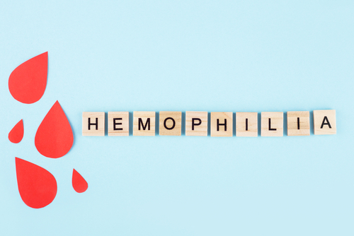 Repeated Desmopressin Dosing Yielded Decreasing Responses in Nonsevere Hemophilia A