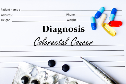 Immunoscore Demonstrates Prognostic Benefits for Patients With Colorectal Cancer