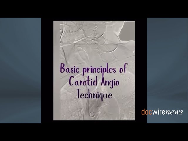 Practice Tips With Dr. Lichaa: The Basic Principles of Carotid Angiography