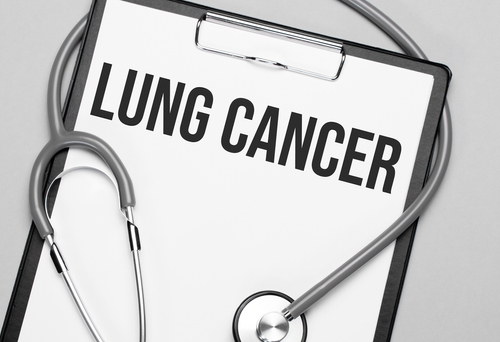 Dostarlimab Plus Chemotherapy Shows Increased OS in Metastatic Nonsquamous NSCLC