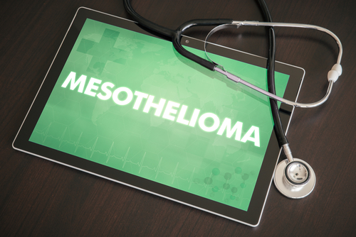 BNP Ratio and Prognosis of Malignant Pleural Mesothelioma