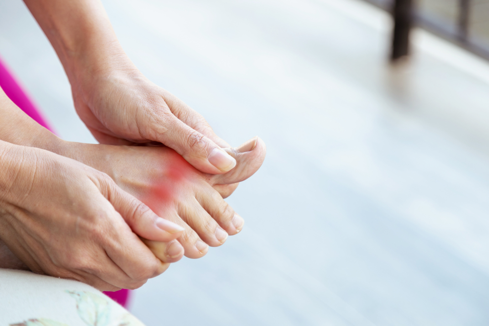 Nrf2 Activation May Reduce Joint Inflammation in Patients With Gout