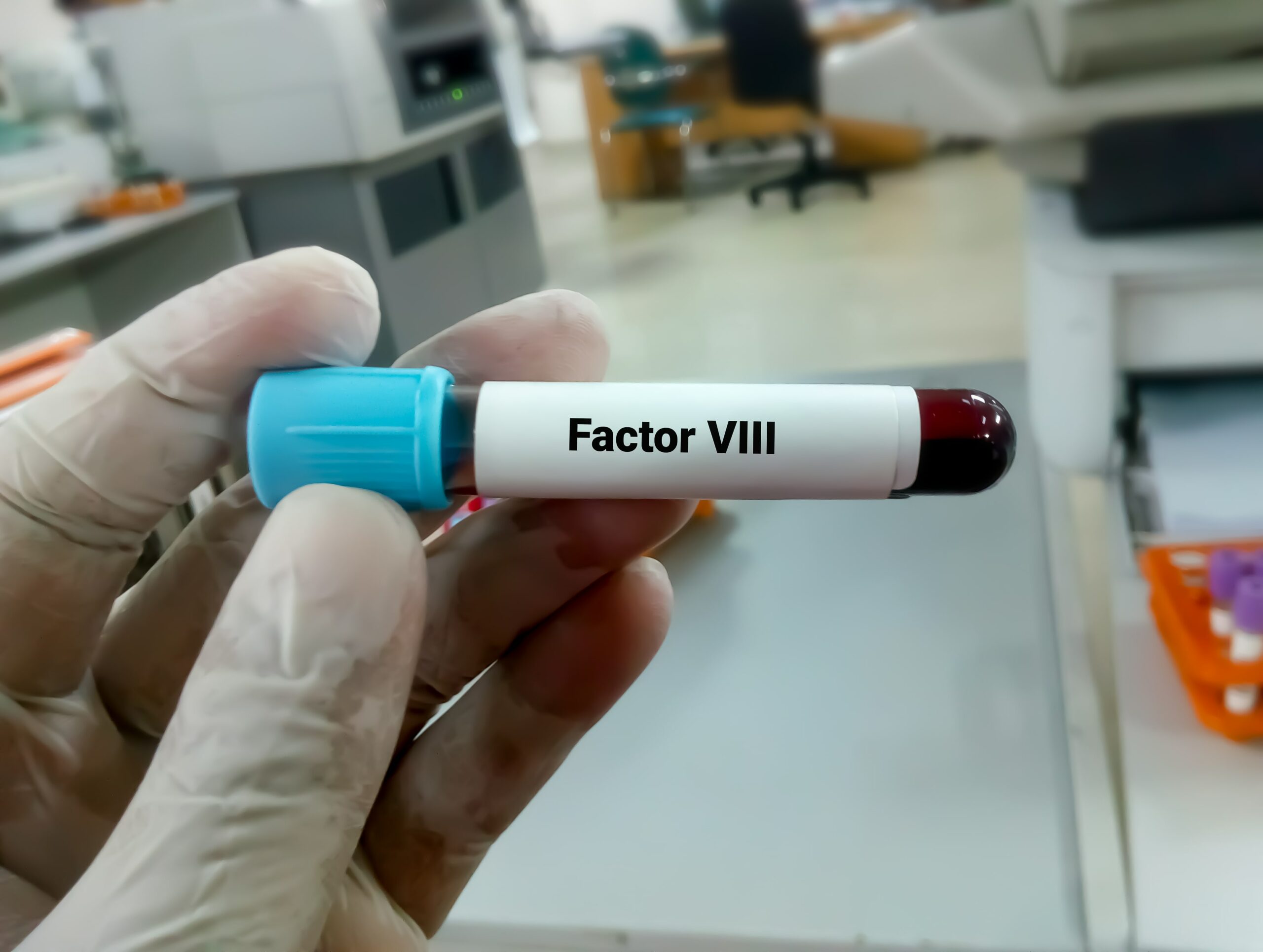 Factor VIII Gene Variants Predict Immune Tolerance Induction Outcomes
