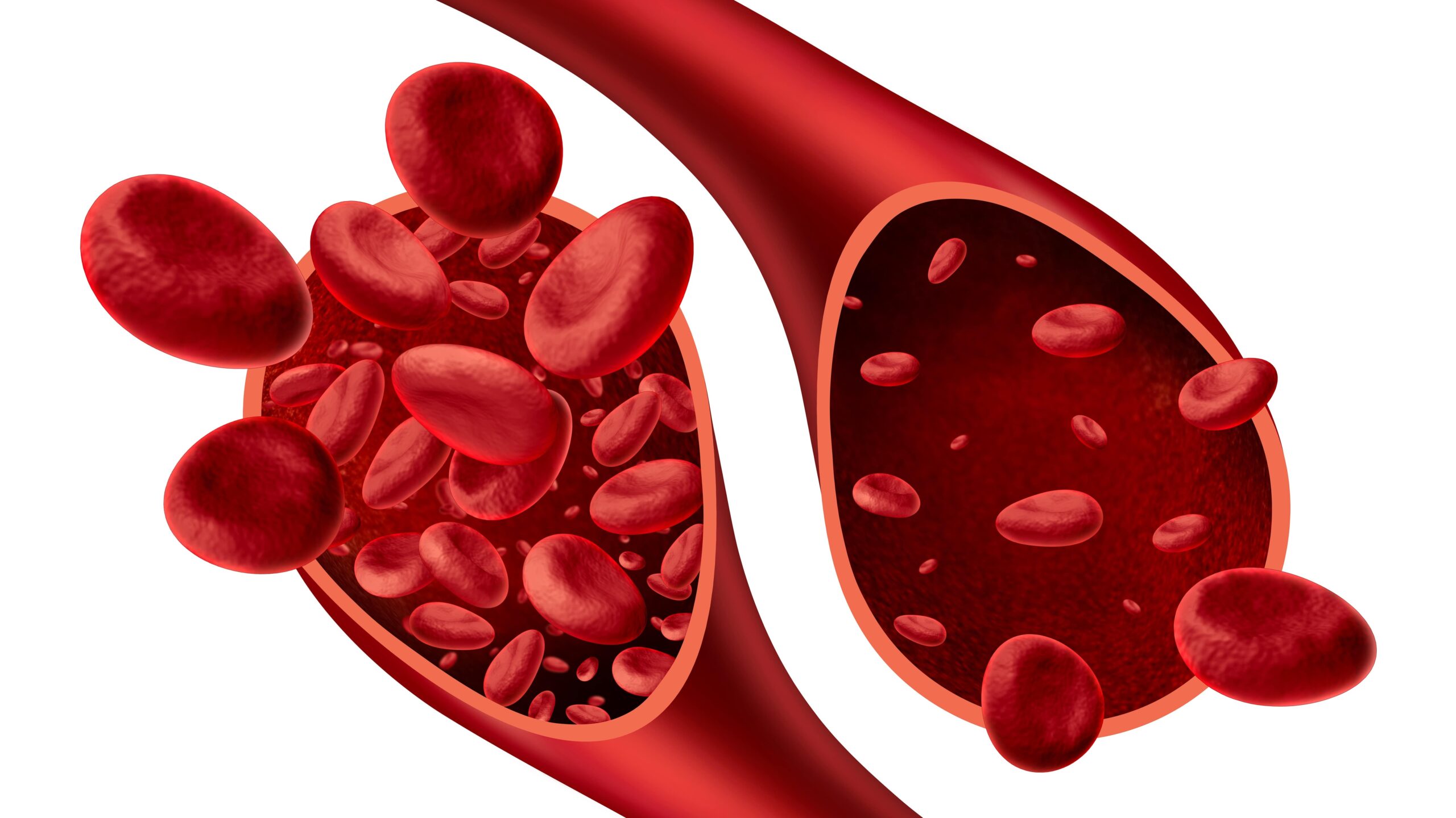 Can HIF-PHIs Replace ESAs For Anemia in Chronic Kidney Disease?