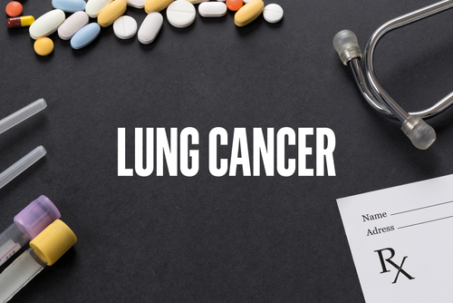 Reducing the Incidence of Advanced Lung Cancer With Interception-Lung: A Study of a Personalized Pilot Lung Cancer Screening and Prevention Program