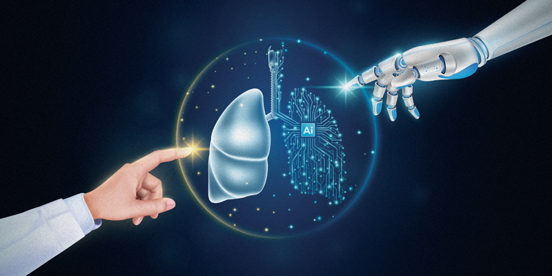 AI Applications in Lung Cancer Ripe With Opportunity