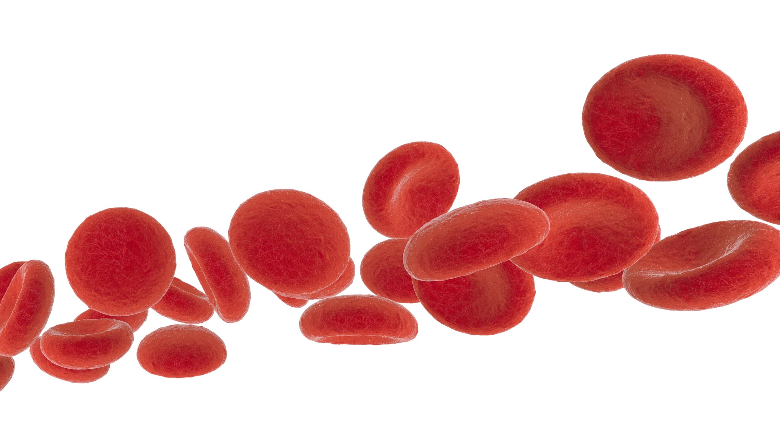 Analysis Finds Anemia, Hemoglobin Associated With Cognitive Impairment