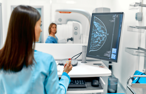 MRI Surveillance Reduces Breast Cancer Mortality in Women With BRCA1 Sequence Variations
