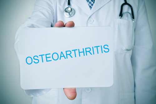 Rates of Early-Onset Osteoarthritis Have Risen Since 1990