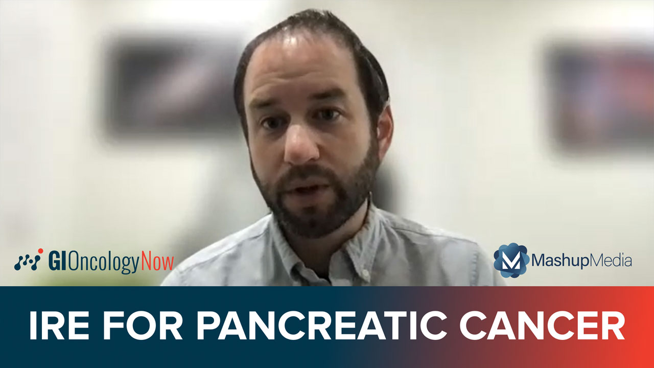 Local Ablation in Pancreatic Cancer: Ongoing Trials and Investigative Directions